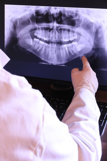 Best Broken or Cracked Tooth Emergency Dentist in Fulton, IL