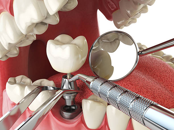 Best Emergency Dentist for Special Needs Patients in Fulton, IL